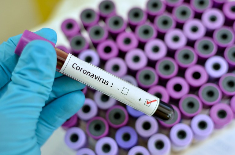 Mulher de 37 anos morre com coronavírus e sobe para 9 número de óbitos em Pernambuco